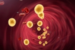Cholesterol In Children latest news, Cholesterol In Children breaking updates, what parents have to know about cholesterol in children, Kids