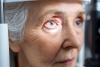 All About the Eye Disease Glaucoma All About the Eye Disease Glaucoma