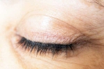 Eyelash Dandruff medication, Eyelash Dandruff health, all about eyelash dandruff, Makeup