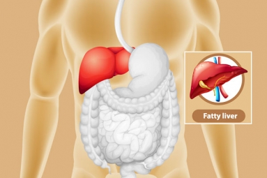 Dangers of Fatty Liver