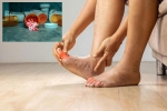 Gout Drugs vs Heart attack, Gout Drugs latest update, gout drugs may cut the risk of heart attack, Medication Gout Drugs vs Heart attack, Gout Drugs latest update, gout drugs may cut the risk of heart attack, Medication