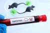 Indian Health Ministry monitoring Hantavirus situation