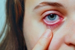 Conjunctivitis Telangana, Conjunctivitis latest, special measures to prevent conjunctivitis, Pink eye