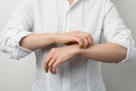 Scabies medicine, Scabies health, how to protect your skin in monsoon season, Pink eye